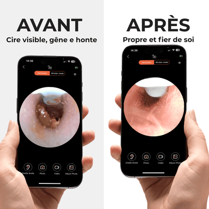 Earo Vision 2.0 - Earo France